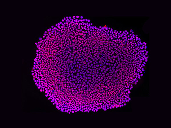 IPS-Induced Brain Organoid Cultivation Strategy(Part Ⅱ)