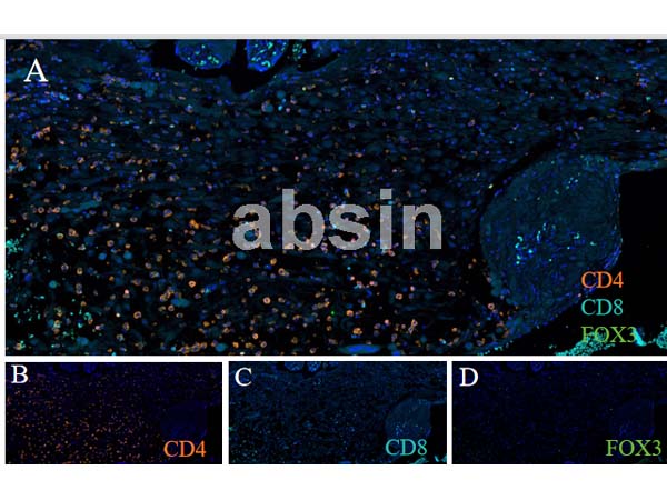 The Great Revelation of ABclonal's Validated Antibodies