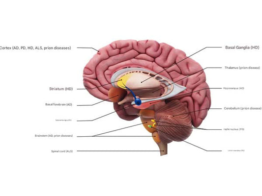 Neurodegenerative disease profile