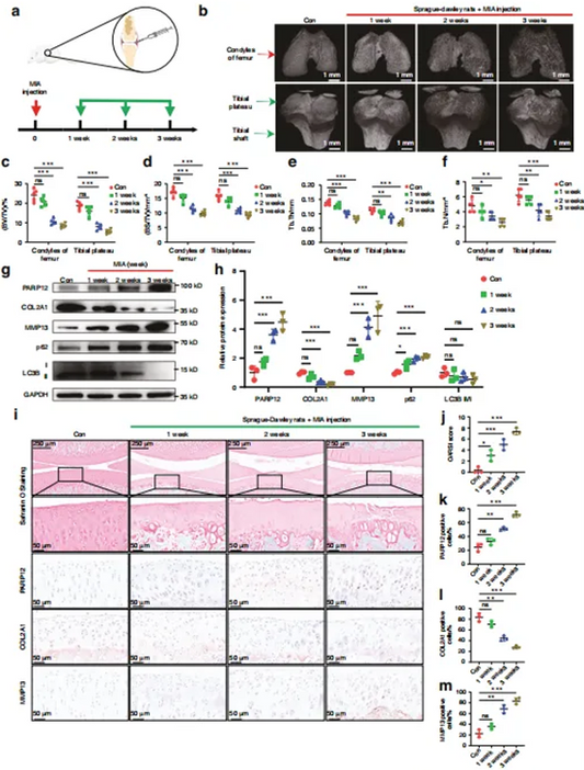 PARP12: A Master Regulator of Cell Death and Antiviral Immunity
