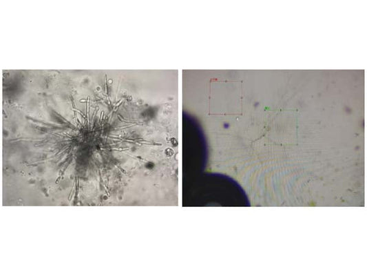 Identification and sterilization strategy of organoid contamination (1)