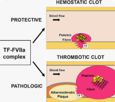 Tissue Factor (TF): A Master Regulator of Coagulation, Inflammation, and Tumor Progression