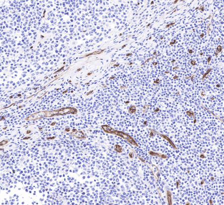 CD34 Recombinant Antibody: Core Biomarker Reagent for Hematopoietic Stem Cell and Vascular Endothelial Basic Research
