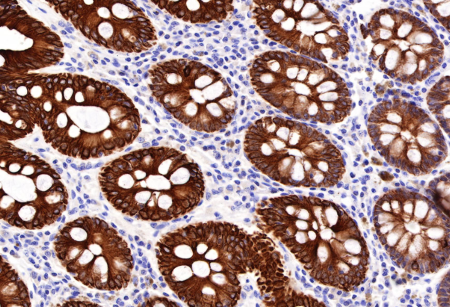 Anti-CD146 Antibodies for Mechanistic Research of Lipid Metabolism and Energy Homeostasis in Adipose Biology