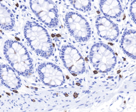 H3K27ac as Metabolic-Epigenetic Link: MCT1-Pyruvate Axis Regulates B Cell Class Switch Recombination