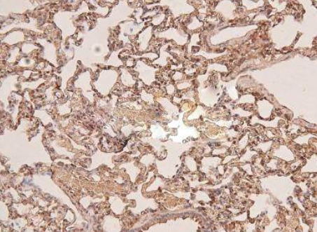 FGFR3 K650Q Gain‑of‑Function Mutation: Molecular Mechanisms and Basic‑Research Investigation Strategies