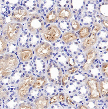 p90RSK Kinase: Recombinant Rabbit Monoclonal Antibody Tools for Probing Multidimensional Kinase‑Signalling Regulation