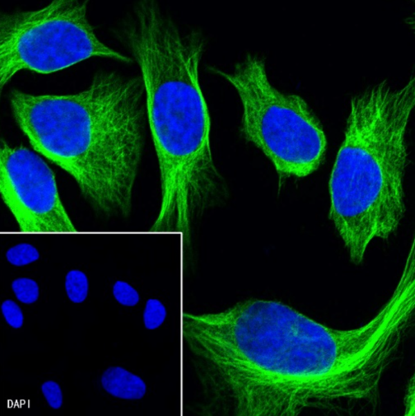 Custom Biopharmaceutical Antibody Services: Enabling Progressive Drug‑Discovery Research Pipelines