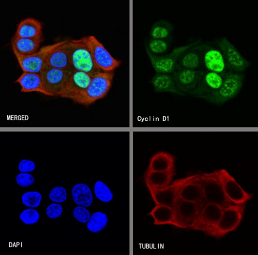 What is the key role of Cyclin D1 antibody in tumor pathological diagnosis?