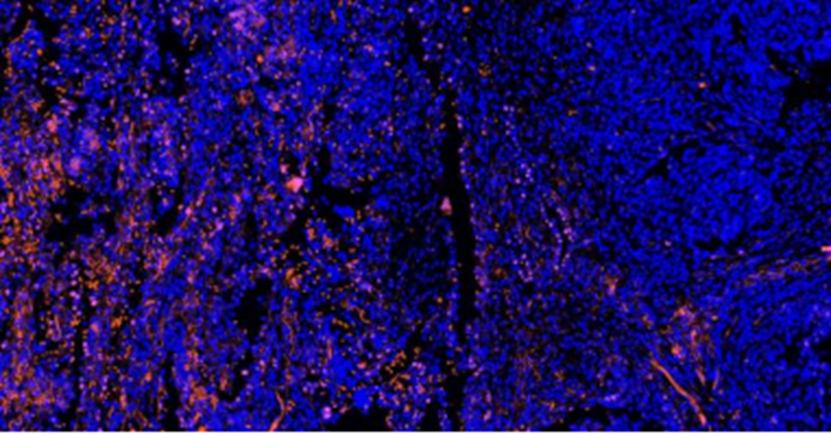 The Mighty Antibody Series 1: IHC Antibodies - The Golden Navigator for DSP Spatial Biology