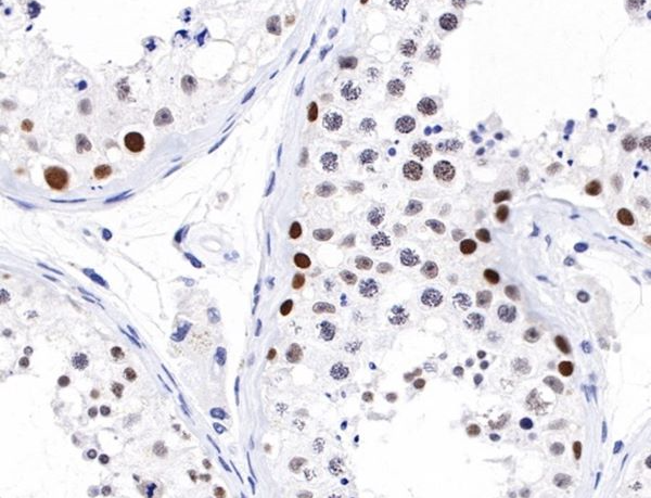 Antibody Specificity Validation &amp; Customization: Core Principles, Pricing Drivers, and ANT BIO’s Comprehensive Solutions