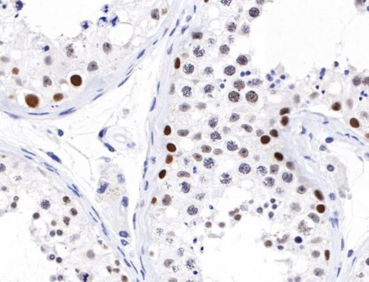 Antibody Specificity Validation &amp; Customization: Core Principles, Pricing Drivers, and ANT BIO’s Comprehensive Solutions