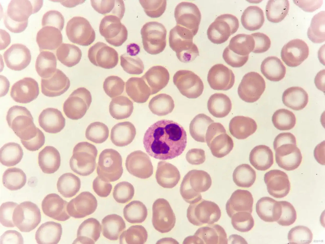 NGL Protein in Kidney Tumor Research: Structure, Expression, and Clinical Value