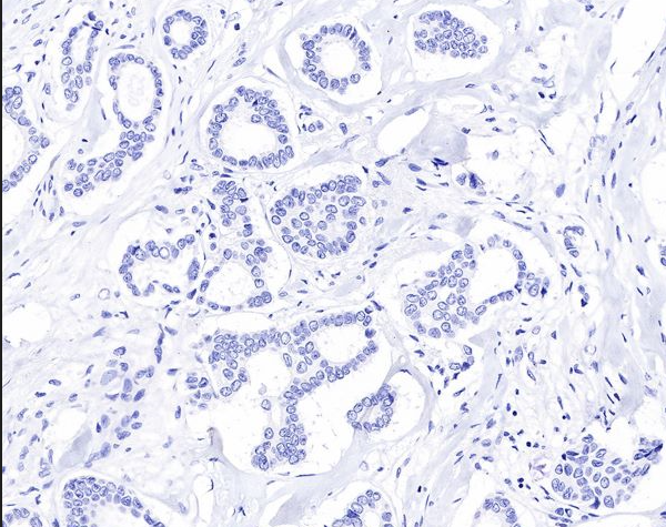 Custom IP Antibodies: Precisely Capture Target Protein Complexes with ANT BIO PTE. LTD.