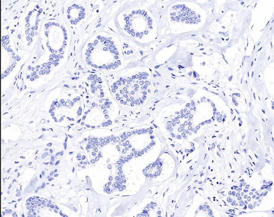 Custom IP Antibodies: Precisely Capture Target Protein Complexes with ANT BIO PTE. LTD.