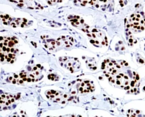 MCM2 Antibodies: The Ideal Tool for Cell Proliferation Assessment and Cervical Cancer Screening by ANT BIO PTE. LTD.