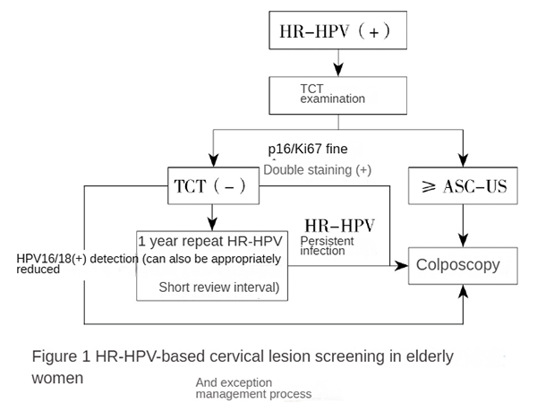 Dual Staining for p16Ki-67: A Precise Approach for the Diagnosis of Cervical Precancerous Lesions