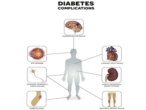 Starter 's HbA1c Monoclonal Antibody Pair: Providing Superior Raw Materials for Diabetes Research and Clinical Diagnosis