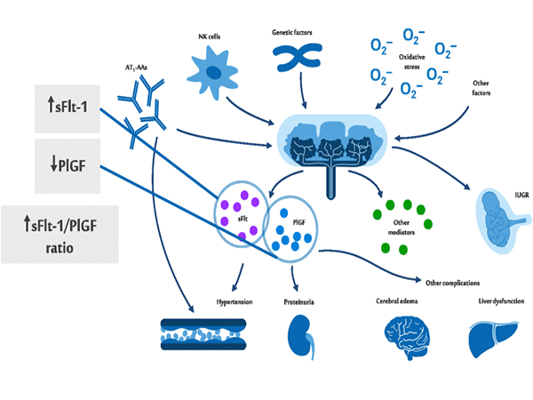 Soluble Fms-like Tyrosine Kinase 1 (sFlt-1): A Precise Predictor of Pregnancy-Related Risks