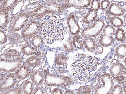 A Guide to Selecting WB Internal Control Antibody