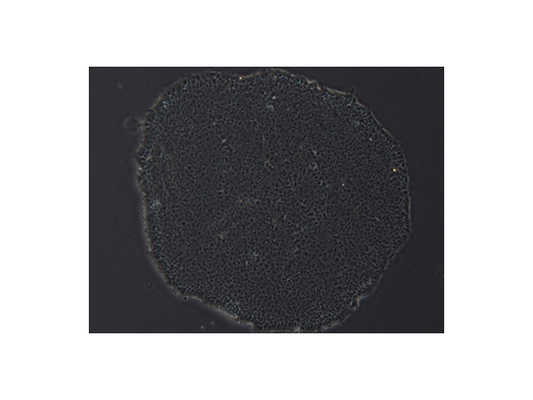 Pluripotent Stem Cell-Derived Neural Stem Cell Differentiation: A Practical Guide