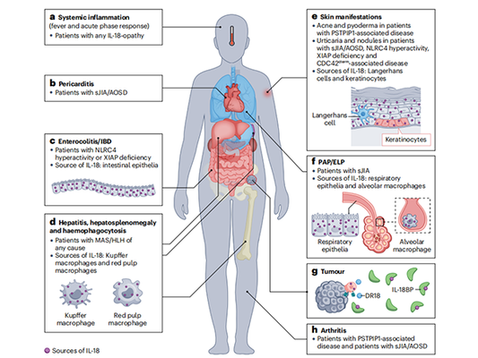 Revitalizing Insights: New Discoveries in the Biology and Clinical Applications of IL-18