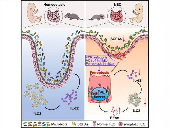 Bile Acid Receptor FXR Regulating Intestinal Epithelial Ferroptosis