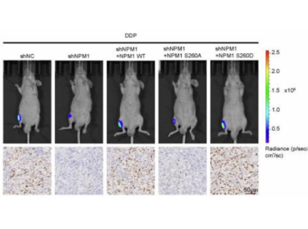 Absin IHC Kit Facilitates Key Discoveries in Osteosarcoma Cisplatin Resistance Research