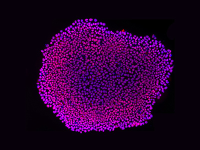 IPS-Induced Brain Organoid Cultivation Strategy(Part Ⅱ)