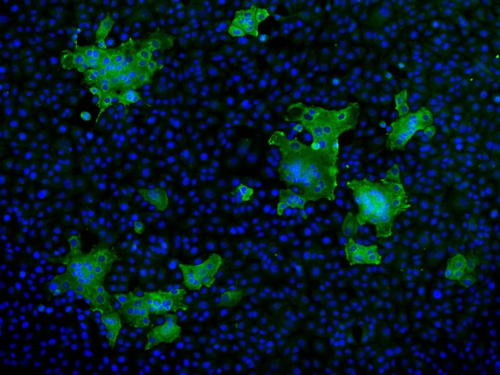 Multiplex Immunohistochemistry (mIHC) vs. Immunofluorescence (IF): Key ...
