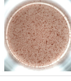 Choosing the Right Biomaker Detection Platform for Drug Development: OneStep ELISA, StepSlim ELISpot and FCM Multiplex