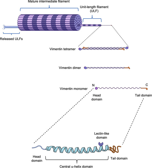 The Pivotal Role of Vimentin-High Macrophages in Immunosuppression of Hepatocellular Carcinoma