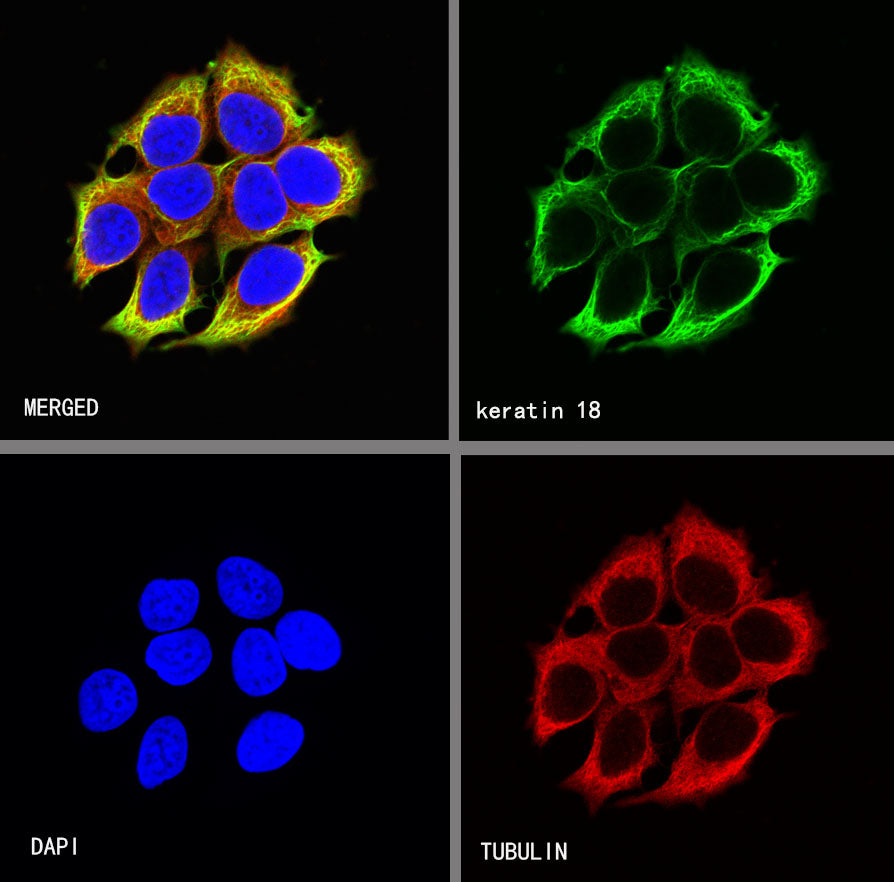 Keratin 18 Recombinant Rabbit mAb (SDT-R081)