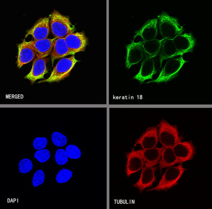 Keratin 18 Recombinant Rabbit mAb (SDT-R081)