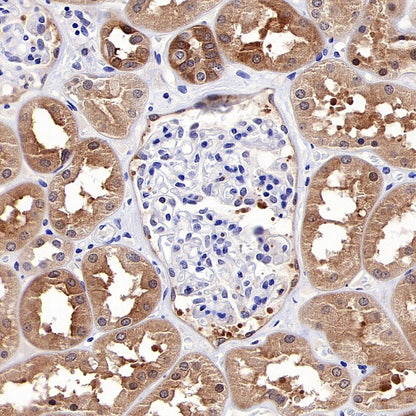 p90RSK Rabbit polyclonal antibody