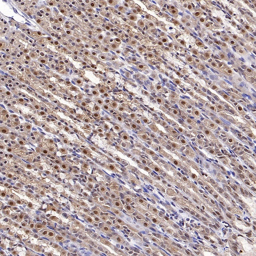 DNA Ligase IV/LIG4 Recombinant Rabbit mAb (S-2237-64)