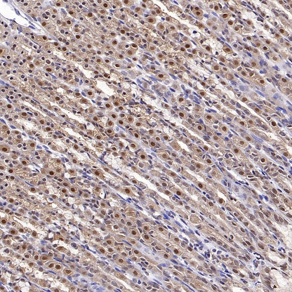 DNA Ligase IV/LIG4 Recombinant Rabbit mAb (S-2237-64)