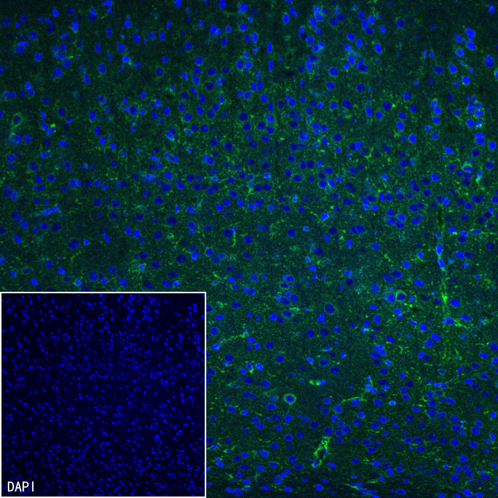 PITX2 Recombinant Rabbit mAb (S-4009-54)