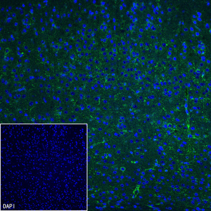 PITX2 Recombinant Rabbit mAb (S-4009-54)