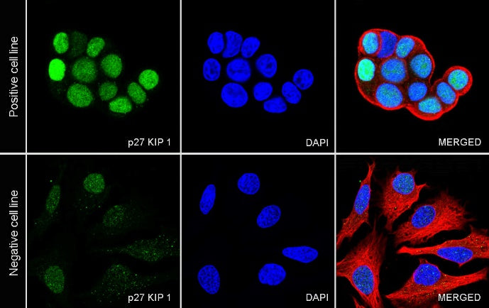 p27 Kip1 Recombinant Rabbit mAb (SDT-361-324)