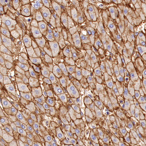 Scavenging Receptor SR-BI Recombinant Rabbit mAb (S-1736-15)
