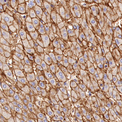 Scavenging Receptor SR-BI Recombinant Rabbit mAb (S-1736-15)