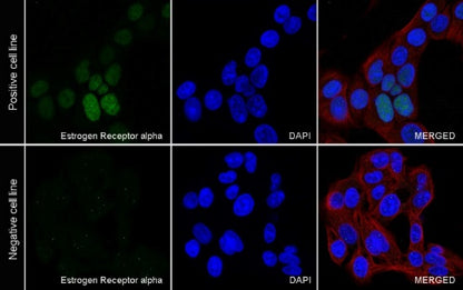 Estrogen Receptor α Recombinant Rabbit mAb (SDT-R371)