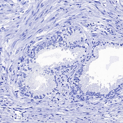 Cardiac Troponin I Recombinant Rabbit mAb (S-1352-15)