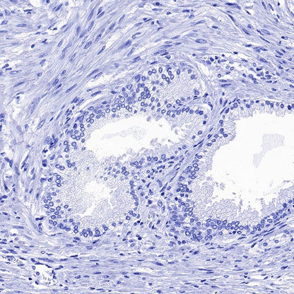 Cardiac Troponin I Recombinant Rabbit mAb (S-1352-15)