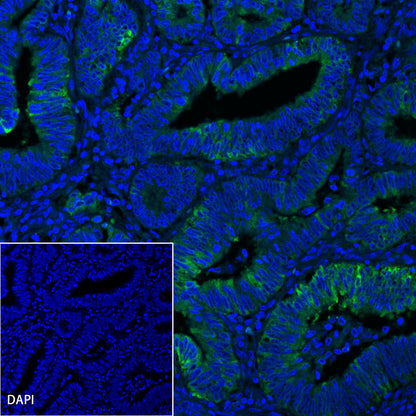 COX2 Recombinant Rabbit mAb (SDT-380-259)