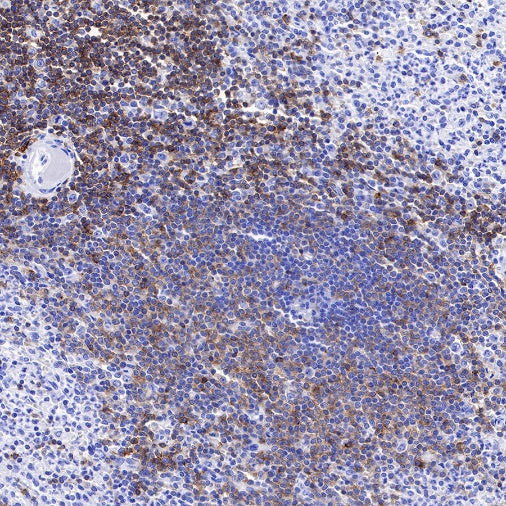 CD27 Mouse mAb (S-568-1)