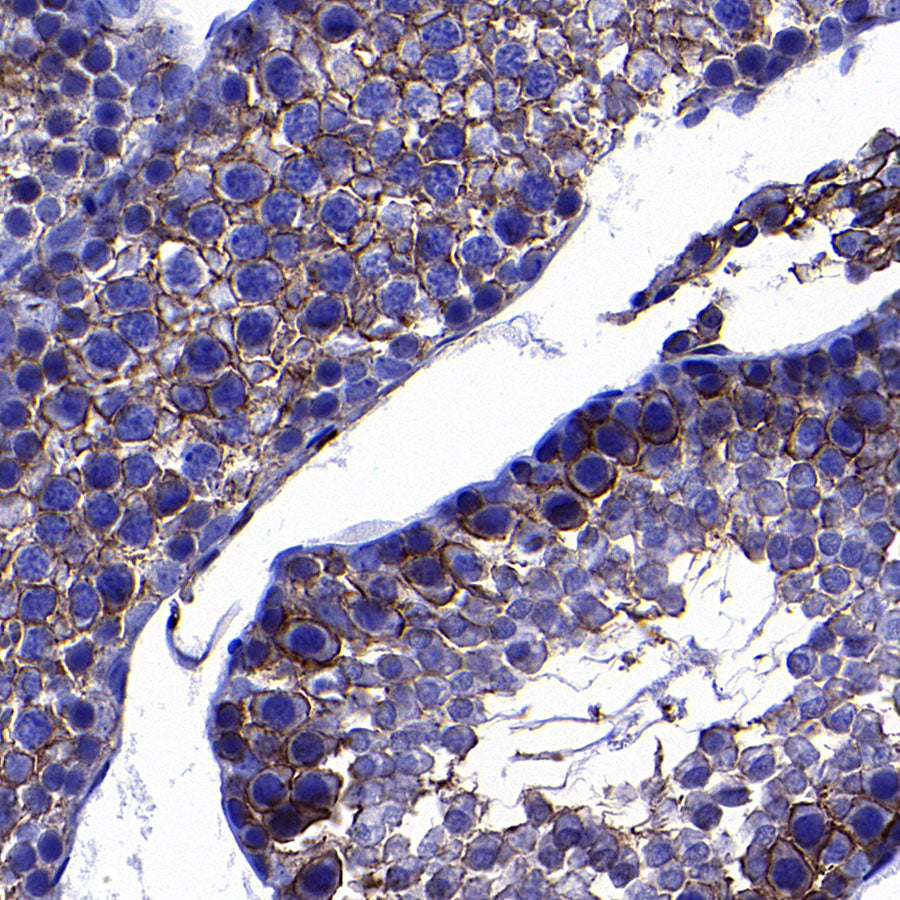 SLC7A5 Recombinant Rabbit mAb (S-4496-55)