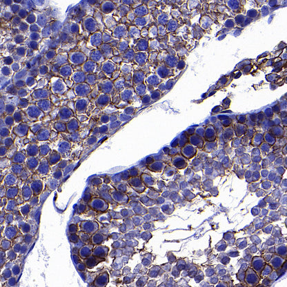 SLC7A5 Recombinant Rabbit mAb (S-4496-55)