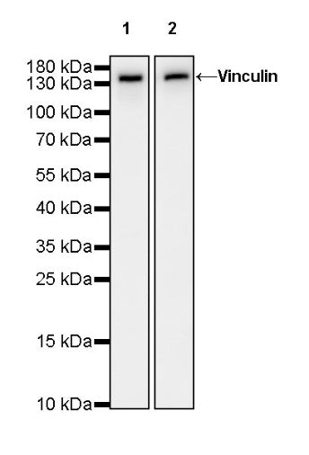 Vinculin Recombinant Rabbit mAb (S-1635-6)